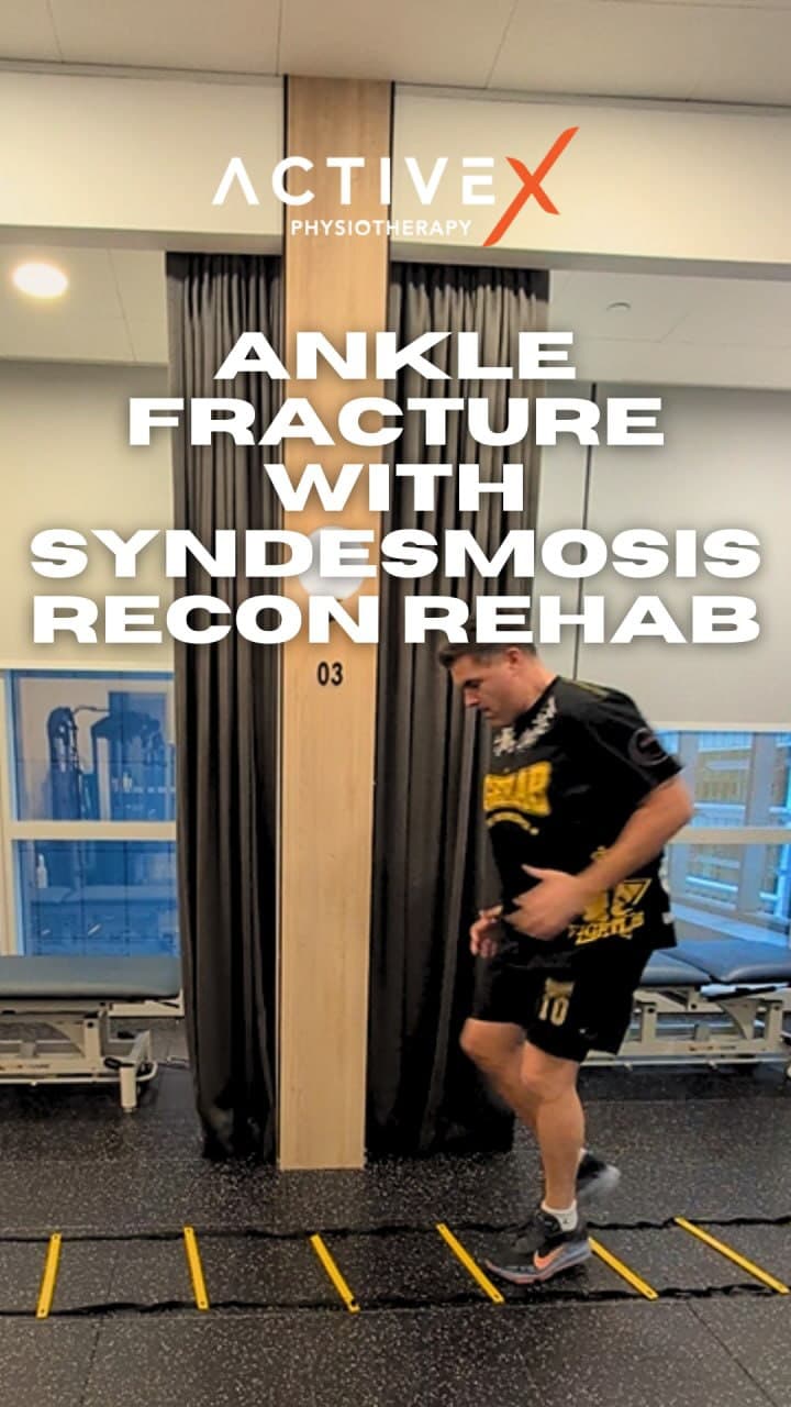 Rehab with us through an ankle fracture & Syndesmosis Reconstruction. 🦶🔧

1st PHASE - PROTECTION �