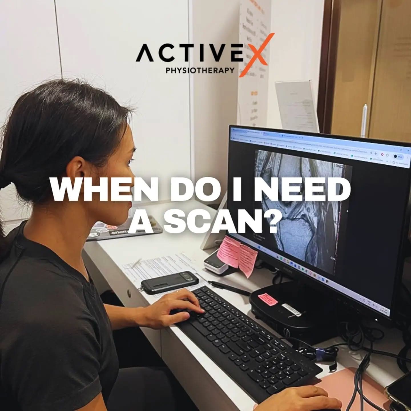 The question we get asked often is whether they need a scan, and it comes down to whether the result